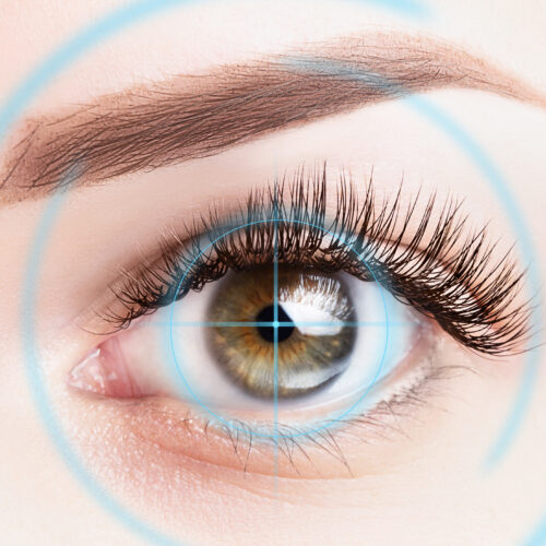 photokératectomie réfractive